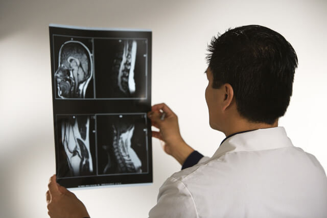 X-Ray Diagnostic Scan of Car Accident Patient